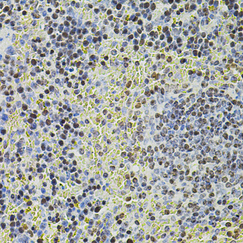 POT1 Antibody - Immunohistochemistry of paraffin-embedded mouse spleen using POT1 antibodyat dilution of 1:100 (40x lens).