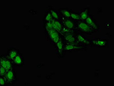 POT1 Antibody - Immunofluorescent analysis of Hela cells diluted at 1:100 and Alexa Fluor 488-congugated AffiniPure Goat Anti-Rabbit IgG(H+L)