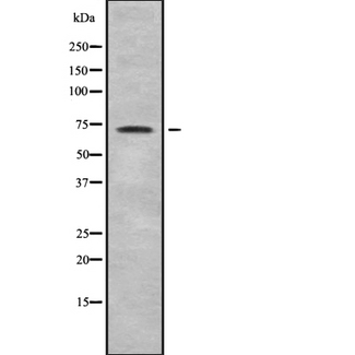 POT1 Antibody - Western blot analysis of POT1 using Jurkat whole cells lysates