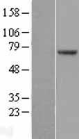 POT1 Protein - Western validation with an anti-DDK antibody * L: Control HEK293 lysate R: Over-expression lysate