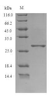 HEV ORF3 Protein - (Tris-Glycine gel) Discontinuous SDS-PAGE (reduced) with 5% enrichment gel and 15% separation gel.