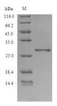 HEV ORF3 Protein - (Tris-Glycine gel) Discontinuous SDS-PAGE (reduced) with 5% enrichment gel and 15% separation gel.