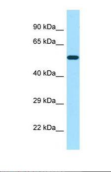 POTEA / POTE8 Antibody - Western blot of Human Jurkat. POTEA antibody dilution 1.0 ug/ml.  This image was taken for the unconjugated form of this product. Other forms have not been tested.