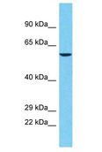 POTEA / POTE8 Antibody - POTEA / POTE8 antibody Western Blot of Jurkat. Antibody dilution: 1 ug/ml.  This image was taken for the unconjugated form of this product. Other forms have not been tested.