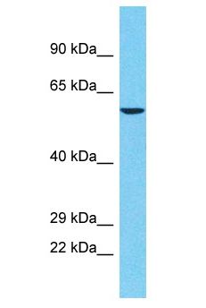 POTEA / POTE8 Antibody - POTEA / POTE8 antibody Western Blot of Jurkat. Antibody dilution: 1 ug/ml.  This image was taken for the unconjugated form of this product. Other forms have not been tested.