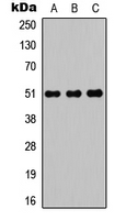 POTEA / POTE8 Antibody - Western blot analysis of POTEA expression in HEK293T (A); Raw264.7 (B); H9C2 (C) whole cell lysates.