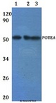 POTEA / POTE8 Antibody - Western blot of POTEA antibody at 1:500 dilution. Lane 1: HEK293T whole cell lysate. Lane 2: RAW264.7 whole cell lysate.