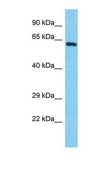 POTEB3 / POTE-15 Antibody - Western blot of Human HepG2. POTEB antibody dilution 1.0 ug/ml.  This image was taken for the unconjugated form of this product. Other forms have not been tested.