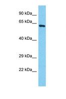 POTEB3 / POTE-15 Antibody - Western blot of Human HepG2. POTEB antibody dilution 1.0 ug/ml.  This image was taken for the unconjugated form of this product. Other forms have not been tested.
