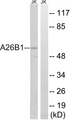 POTEB3 / POTE-15 Antibody - Western blot analysis of lysates from Jurkat cells, using A26B1 Antibody. The lane on the right is blocked with the synthesized peptide.