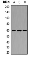 POTEB3 / POTE-15 Antibody - Western blot analysis of POTEB expression in Jurkat (A); mouse kidney (B); NIH3T3 (C) whole cell lysates.