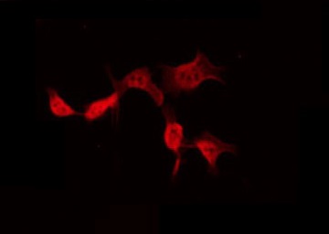 POTEB3 / POTE-15 Antibody - Staining HeLa cells by IF/ICC. The samples were fixed with PFA and permeabilized in 0.1% Triton X-100, then blocked in 10% serum for 45 min at 25°C. The primary antibody was diluted at 1:200 and incubated with the sample for 1 hour at 37°C. An Alexa Fluor 594 conjugated goat anti-rabbit IgG (H+L) Ab, diluted at 1/600, was used as the secondary antibody.