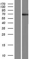 POTEC Protein - Western validation with an anti-DDK antibody * L: Control HEK293 lysate R: Over-expression lysate