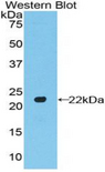 POTEG Antibody - Western blot of recombinant POTEG.  This image was taken for the unconjugated form of this product. Other forms have not been tested.