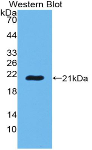 POTEG Antibody - Western blot of recombinant POTEG.