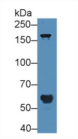 POTEG Antibody - Western Blot; Sample: Human Serum; Primary Ab: 5µg/ml Rabbit Anti-Human POTEG Antibody Second Ab: 0.2µg/mL HRP-Linked Caprine Anti-Rabbit IgG Polyclonal Antibody