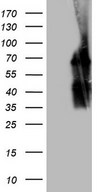 POTEG Antibody - HEK293T cells were transfected with the pCMV6-ENTRY control. (Left lane) or pCMV6-ENTRY POTEG. (Right lane) cDNA for 48 hrs and lysed