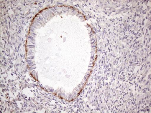 POTEG Antibody - Immunohistochemical staining of paraffin-embedded Human endometrium tissue within the normal limits using anti-POTEG mouse monoclonal antibody. (Heat-induced epitope retrieval by 1mM EDTA in 10mM Tris buffer. (pH8.5) at 120°C for 3 min. (1:150)