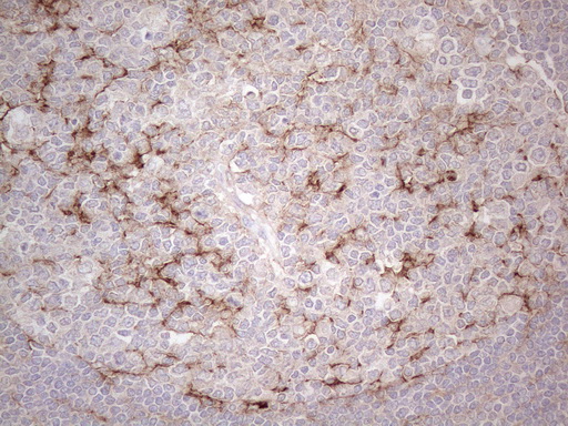 POTEG Antibody - Immunohistochemical staining of paraffin-embedded Human lymph node tissue within the normal limits using anti-POTEG mouse monoclonal antibody. (Heat-induced epitope retrieval by 1mM EDTA in 10mM Tris buffer. (pH8.5) at 120°C for 3 min. (1:150)