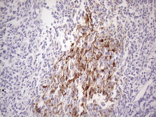 POTEG Antibody - Immunohistochemical staining of paraffin-embedded Human tonsil within the normal limits using anti-POTEG mouse monoclonal antibody. (Heat-induced epitope retrieval by 1mM EDTA in 10mM Tris buffer. (pH8.5) at 120°C for 3 min. (1:150)