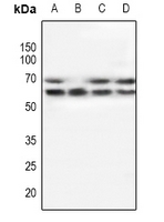 POTEG Antibody - Western blot analysis of POTEG expression in A549 (A), mouse testis (B), rat testis (C), mouse brain (D) whole cell lysates.
