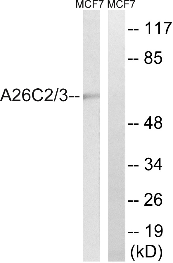 POTEH Antibody - Western blot analysis of lysates from MCF-7 cells, using A26C2/3 Antibody. The lane on the right is blocked with the synthesized peptide.