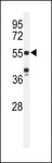 POTEH Antibody - Western blot of POTEH Antibody in HeLa cell line lysates (35 ug/lane). POTEH (arrow) was detected using the purified antibody.
