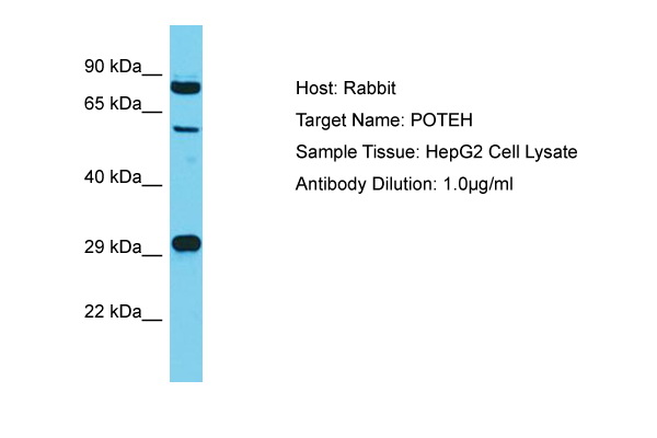 POTEH Antibody -  This image was taken for the unconjugated form of this product. Other forms have not been tested.