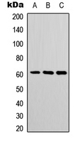 POTEH Antibody - Western blot analysis of POTEH expression in COLO205 (A); mouse spleen (B); mouse heart (C) whole cell lysates.