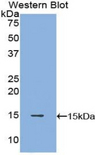 POTEJ Antibody - Western blot of recombinant POTEJ.  This image was taken for the unconjugated form of this product. Other forms have not been tested.