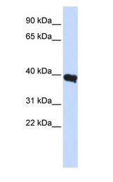 POU1F1 / PIT1 Antibody - POU1F1 / PIT1 / PIT-1 antibody Western Blot of Human Liver.  This image was taken for the unconjugated form of this product. Other forms have not been tested.