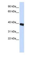 POU1F1 / PIT1 Antibody - POU1F1 / PIT1 / PIT-1 antibody Western Blot of Human Liver.  This image was taken for the unconjugated form of this product. Other forms have not been tested.