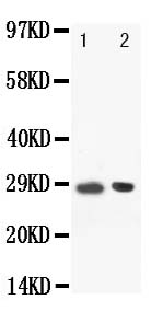 POU2AF1 / BOB1 Antibody - Anti-BOB1 antibody, Western blotting Lane: Rat Spleen Tissue Lysate