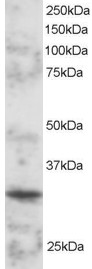 POU2AF1 / BOB1 Antibody - Staining (2 ug/ml) of Mouse Spleen lysate (RIPA buffer, 30 ug total protein per lane). Primary incubated for 1 hour. Detected by chemiluminescence.