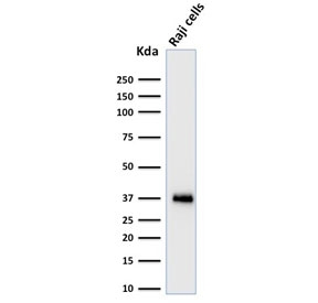 POU2AF1 / BOB1 Antibody - Western blot testing of human Raji cell lysate with BOB-1 antibody (clone BOB1/2424). Predicted molecular weight: ~28 kDa (unmodified), 35-40 kDa (ubiquitinated).