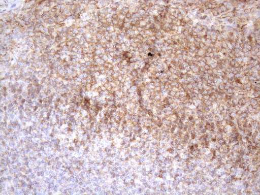 POU2AF1 / BOB1 Antibody - Immunohistochemical staining of paraffin-embedded Human tonsil within the normal limits using anti-POU2AF1 mouse monoclonal antibody. (Heat-induced epitope retrieval by 1mM EDTA in 10mM Tris buffer. (pH8.5) at 120°C for 3 min. (1:150)