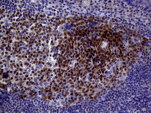 POU2AF1 / BOB1 Antibody - Immunohistochemical staining of paraffin-embedded Human tonsil using anti-POU2AF1 mouse monoclonal antibody. (Heat-induced epitope retrieval by 1mM EDTA in 10mM Tris buffer. (pH8.0) at 120°C for 3 min. (1:200)