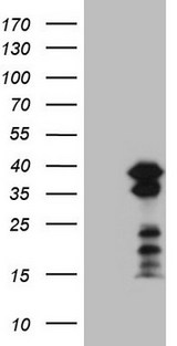 POU2AF1 / BOB1 Antibody - HEK293T cells were transfected with the pCMV6-ENTRY control. (Left lane) or pCMV6-ENTRY POU2AF1. (Right lane) cDNA for 48 hrs and lysed