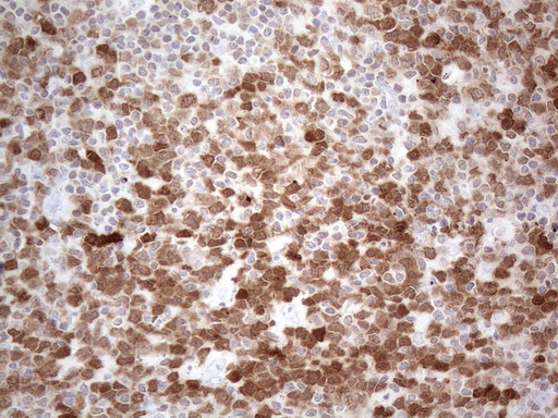 POU2AF1 / BOB1 Antibody - Immunohistochemical staining of paraffin-embedded Human lymph node tissue within the normal limits using anti-POU2AF1 mouse monoclonal antibody. (Heat-induced epitope retrieval by 1mM EDTA in 10mM Tris buffer. (pH8.5) at 120°C for 3 min. (1:150)