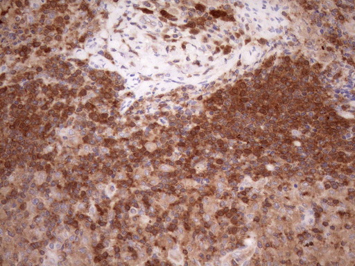 POU2AF1 / BOB1 Antibody - Immunohistochemical staining of paraffin-embedded Human lymph node tissue within the normal limits using anti-POU2AF1 mouse monoclonal antibody at 1:150. (Heat-induced epitope retrieval by 1mM EDTA in 10mM Tris buffer. (pH8.5) at 120°C for 3 min. (1:150)