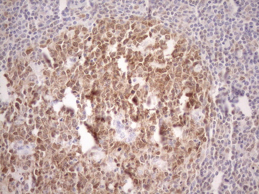 POU2AF1 / BOB1 Antibody - Immunohistochemical staining of paraffin-embedded Human tonsil within the normal limits using anti-POU2AF1 mouse monoclonal antibody. (Heat-induced epitope retrieval by 1mM EDTA in 10mM Tris buffer. (pH8.5) at 120°C for 3 min. (1:150)