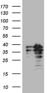 POU2AF1 / BOB1 Antibody - HEK293T cells were transfected with the pCMV6-ENTRY control. (Left lane) or pCMV6-ENTRY POU2AF1. (Right lane) cDNA for 48 hrs and lysed. Equivalent amounts of cell lysates. (5 ug per lane) were separated by SDS-PAGE and immunoblotted with anti-POU2AF1. (1:2000)