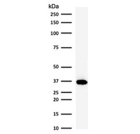 POU2AF1 / BOB1 Antibody - Western blot testing of human Raji cell lysate with BOB-1 antibody (clone PD2AF1-1). Predicted molecular weight: ~28 kDa (unmodified), 35-40 kDa (ubiquitinated).