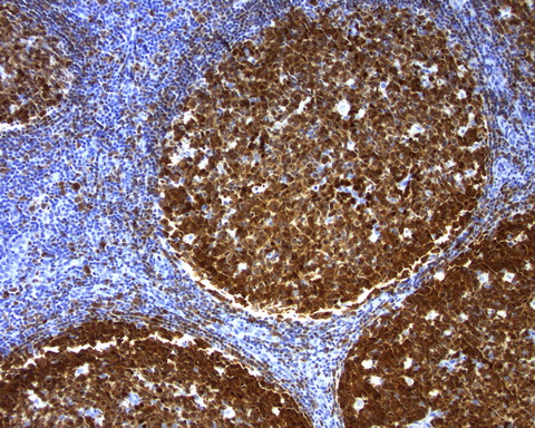 POU2AF1 / BOB1 Antibody - Immunohistochemical staining of paraffin-embedded tonsil using mouse anti-POU2AF1 clone UMAB219  at 1:200 with Polink2 Broad HRP DAB detection kit; pretreatment of tissue prior to stain with heat-induced epitope retrieval with EDTA pH 8.0 buffer using pressure chamber for 3 minutes at 110C is required for optimal staining. Cells exhibit cytoplamic and membranous staining .