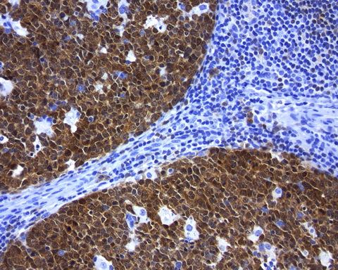 POU2AF1 / BOB1 Antibody - Immunohistochemical staining of paraffin-embedded tonsil using mouse anti-POU2AF1 clone UMAB220  at 1:200 with Polink2 Broad HRP DAB detection kit; pretreatment of tissue prior to stain with heat-induced epitope retrieval with EDTA pH 8.0 buffer using pressure chamber for 3 minutes at 110C is required for optimal staining. Cells exhibit cytoplamic and membranous staining .