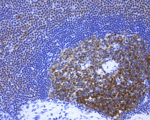 POU2AF1 / BOB1 Antibody - Immunohistochemical staining of paraffin-embedded normal spleen using mouse anti-POU2AF1 clone UMAB220  at 1:200 with Polink2 Broad HRP DAB detection kit; pretreatment of tissue prior to stain with heat-induced epitope retrieval with EDTA pH 8.0 buffer using pressure chamber for 3 minutes at 110C is required for optimal staining. Cells exhibit cytoplamic and membranous staining .