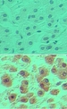 POU2F1 / OCT1 Antibody - IHC of OCT-1 in formalin-fixed, paraffin-embedded human liver tissue using an isotype control (top) and Peptide-affinity Purified Polyclonal Antibody toOCTL1/OCT-1 (bottom) at 5 ug/ml.