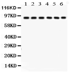 POU2F1 / OCT1 Antibody - Oct-1 antibody Western blot. All lanes: Anti Oct-1 at 0.5 ug/ml. Lane 1: Rat Liver Tissue Lysate at 50 ug. Lane 2: Human Placenta Tissue Lysate at 50 ug. Lane 3: JURKAT Whole Cell Lysate at 40 ug. Lane 4: HELA Whole Cell Lysate at 40 ug. Lane 5: A549 Whole Cell Lysate at 40 ug. Lane 6: SMMC Whole Cell Lysate at 40 ug. Predicted band size: 90 kD. Observed band size: 90 kD.
