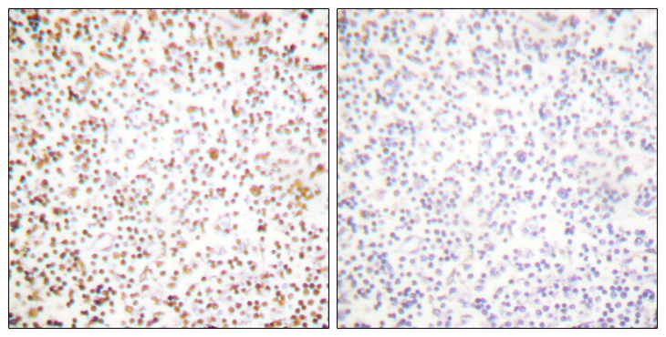 POU2F1 / OCT1 Antibody - Immunohistochemistry analysis of paraffin-embedded human lymph node tissue, using OCT1 Antibody. The picture on the right is blocked with the synthesized peptide.