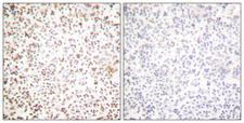 POU2F1 / OCT1 Antibody - Immunohistochemistry analysis of paraffin-embedded human lymph node tissue, using OCT1 Antibody. The picture on the right is blocked with the synthesized peptide.